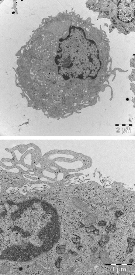 Nordic Preclinical Sciences Monocyte And Macrophage Activation Test